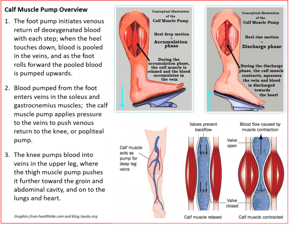 Calf Muscle Pump  Steinmann Prosthetics & Orthotics