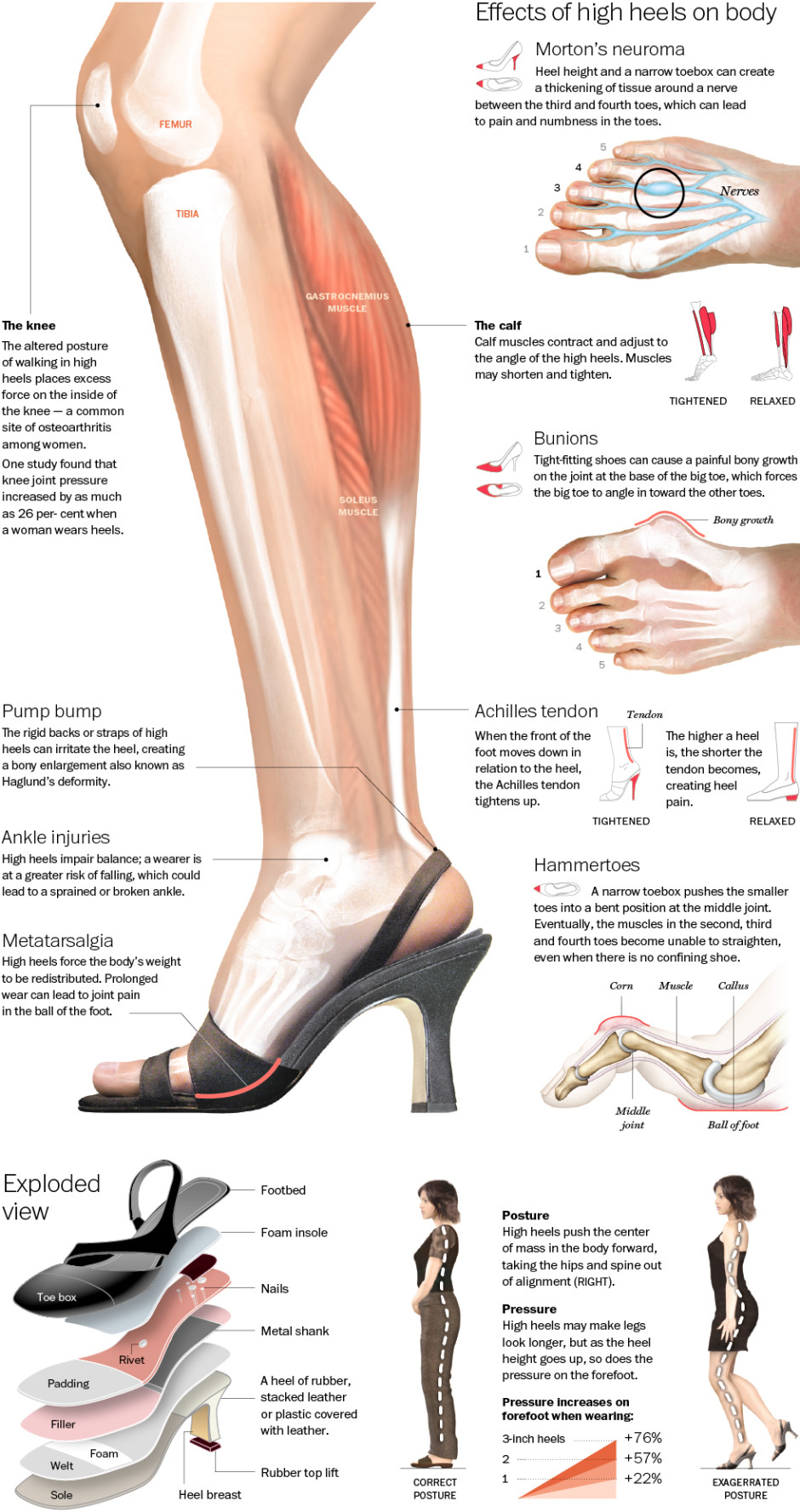 Foot care effect of high heels