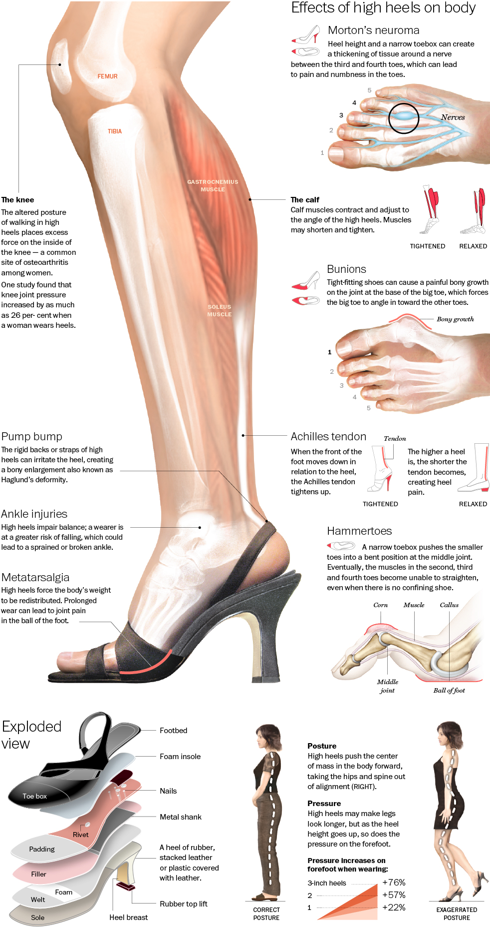 effect of high heels Foot care effect of high heels